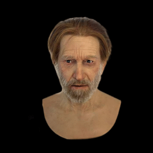 William hair transplant costume props headgear