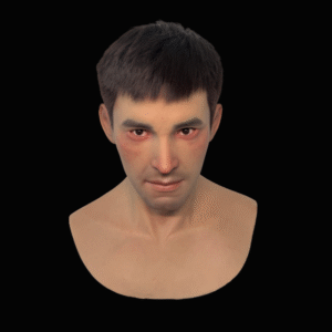 Richie hair transplant handsome mask headgear